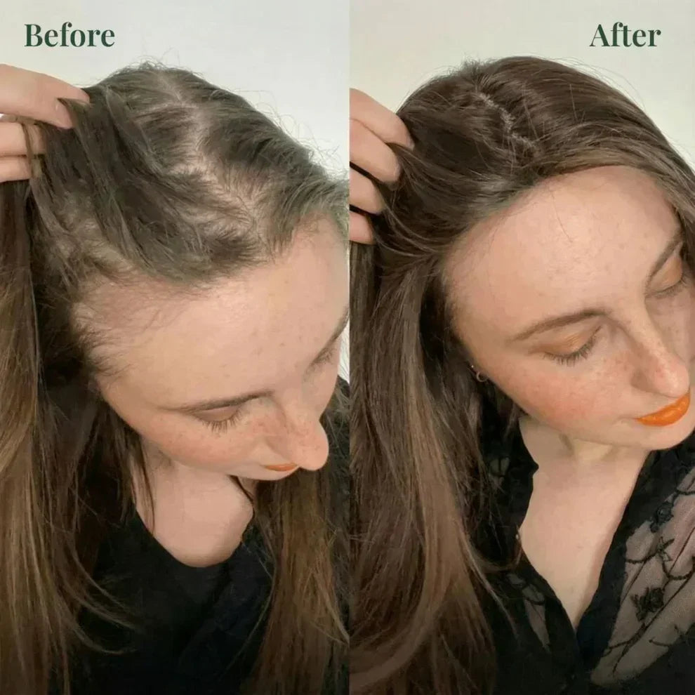Zenith Cart Rosemary Hair Growth Shampoo – Rosemary + Keratin | Strengthens Hair & Supports Growth | Buy 1 Get 1 FREE